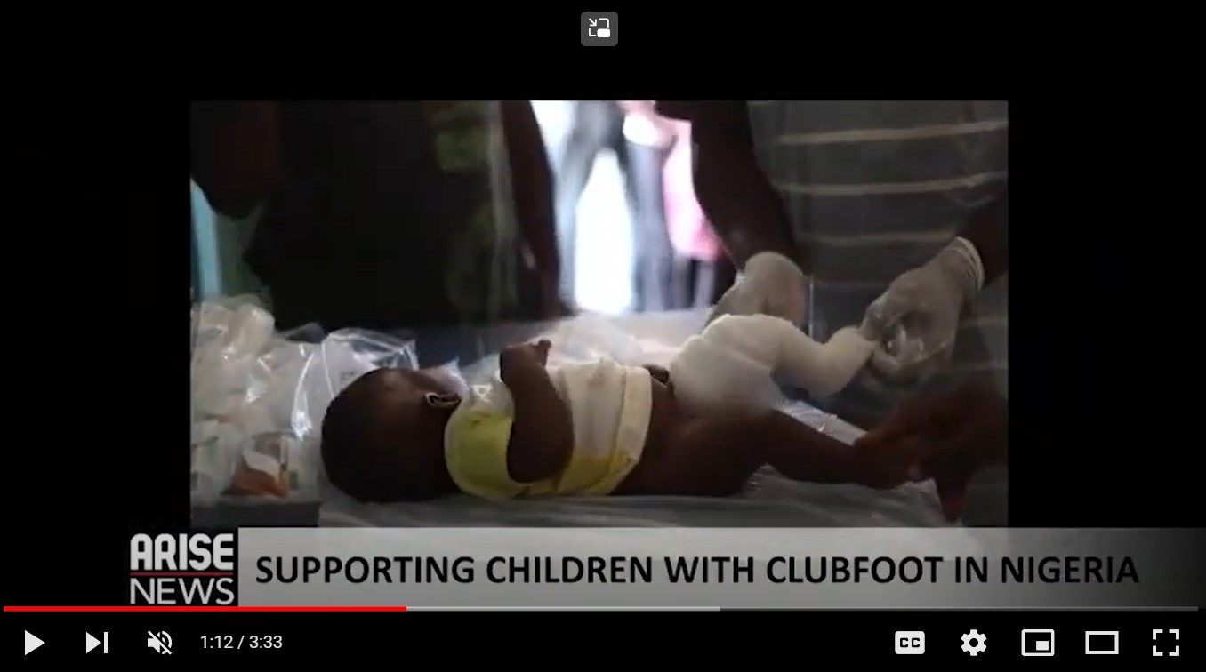 Screen shot of the news piece - with image of young child with foot casting lying in a darkened room. Cover Image