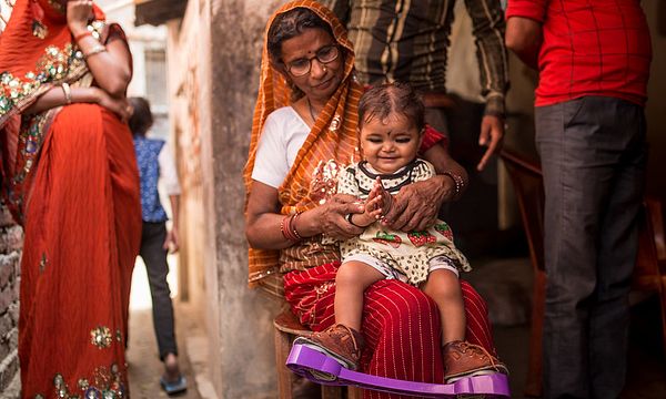 A child sat on parents lap wearing a leg brace to help correct clubfoot