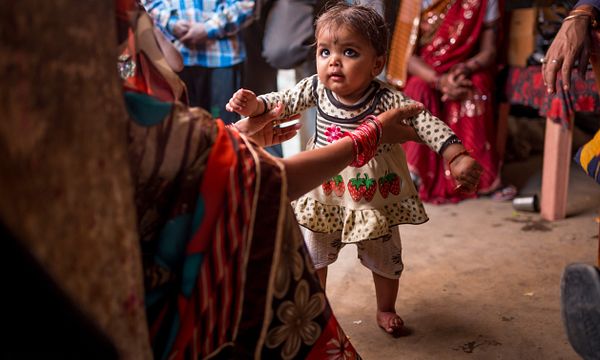 The same child walking without the brace, bare foot