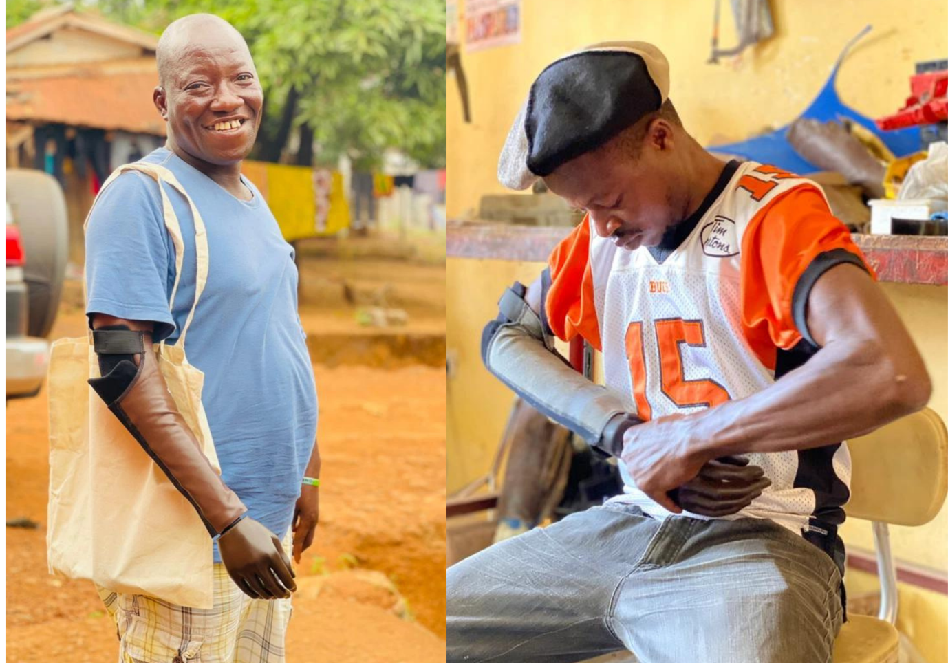 Two images side by side. The image on the left is of a man standing wearing his upper limb prosthesis. He is smiling towards the camera and carrying a shopping bag. The image on the right is of a man fitting his own upper limb prosthesis